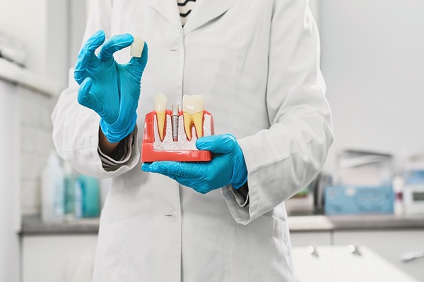 Should I Be Concerned About A Black Line Around My Dental Crown?