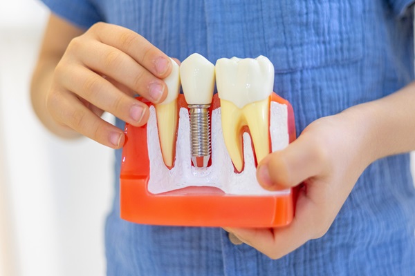 Get A Dental Implant Restoration After Tooth Extraction